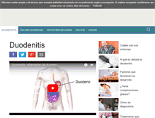 Tablet Screenshot of duodenitis.info